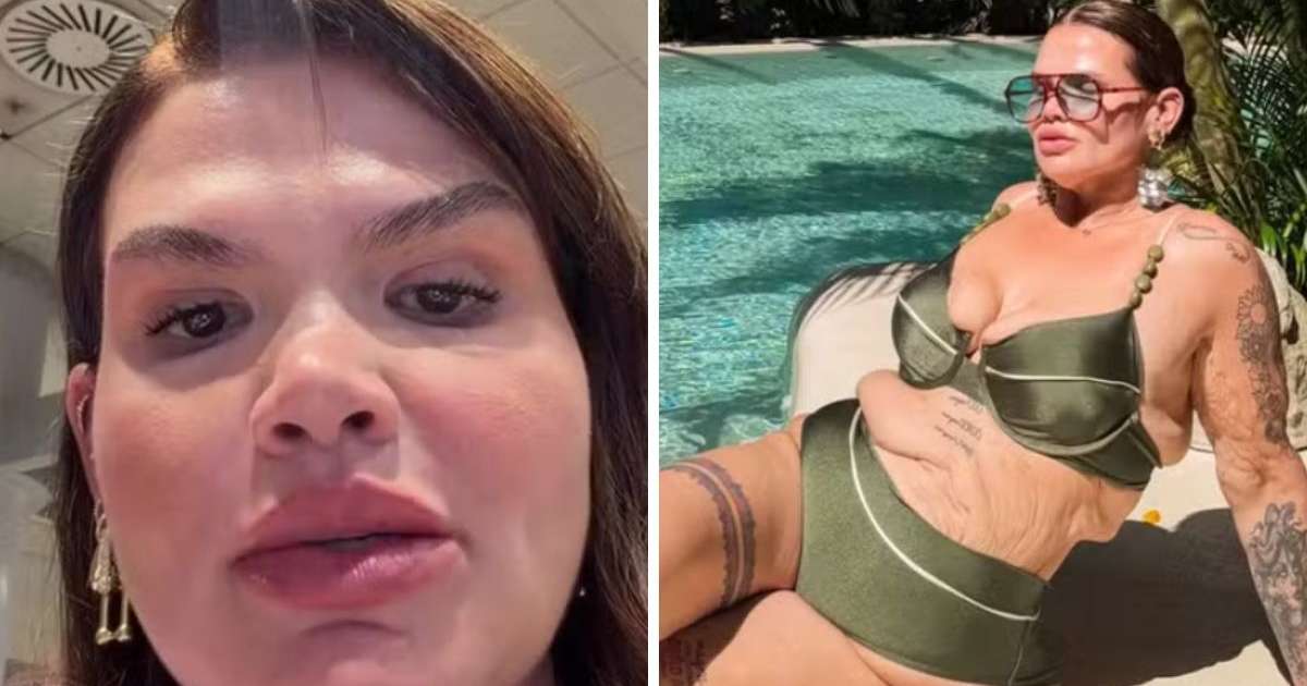 Thais Carla se prepara para cirurgia de remoção de pele após perder 120 kg: 'Virada de vida'