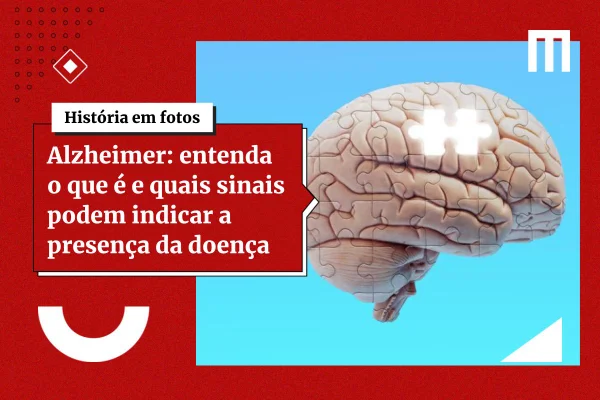 Cientistas identificam alvo no cérebro para conter inflamação no Alzheimer