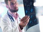 Cientistas identificam alvo no cérebro para conter inflamação no Alzheimer
